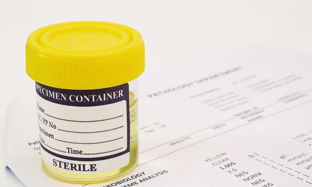 Antibiyotik almadan önce idrar testi yaptırmalısınız